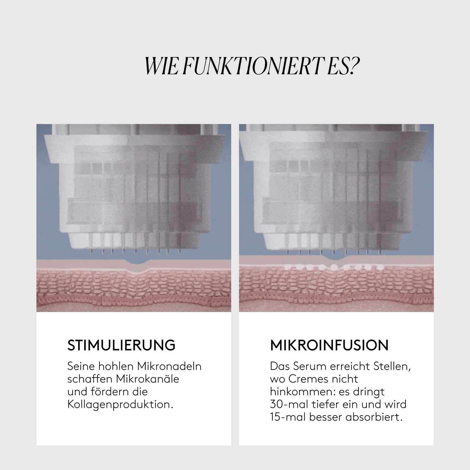 CLINICAL BEAUTY FILLER – Anti-Falten-Behandlung – 1 Anwendung – Fortschrittliche Technologie – Bekämpft Hauterschlaffung – Einfach, Schmerzfrei und Sicher – Mit Hyaluronsäure und Peptiden | Mit Hyaluronsäure, Matrixyl und Argireline, straffend, reduziert