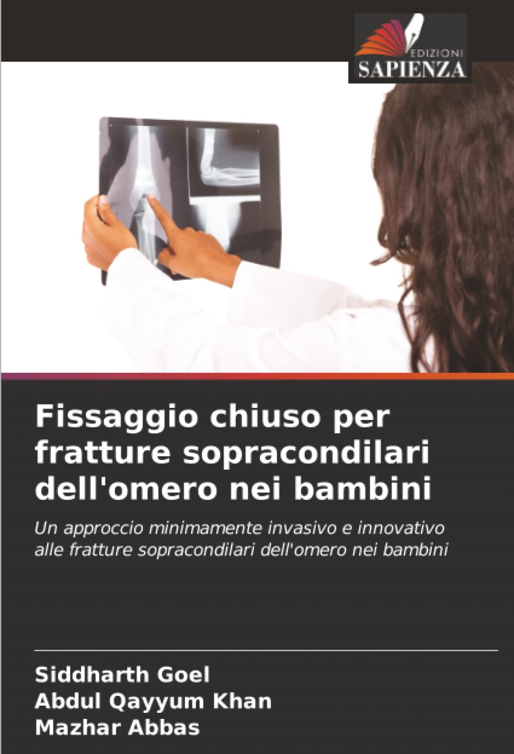 Fissaggio chiuso per fratture sopracondilari dell'omero nei bambini: Un approccio minimamente invasivo e innovativo alle fratture sopracondilari dell'omero nei bambini