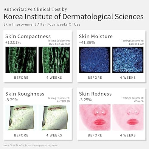 HIME SAMA LED Face Mask – 8 Color Light Mask for Skin Care, Red & Blue Light, Infrared, Wireless Design, Anti-Aging (Miracle ACE RB-081) - Image 4