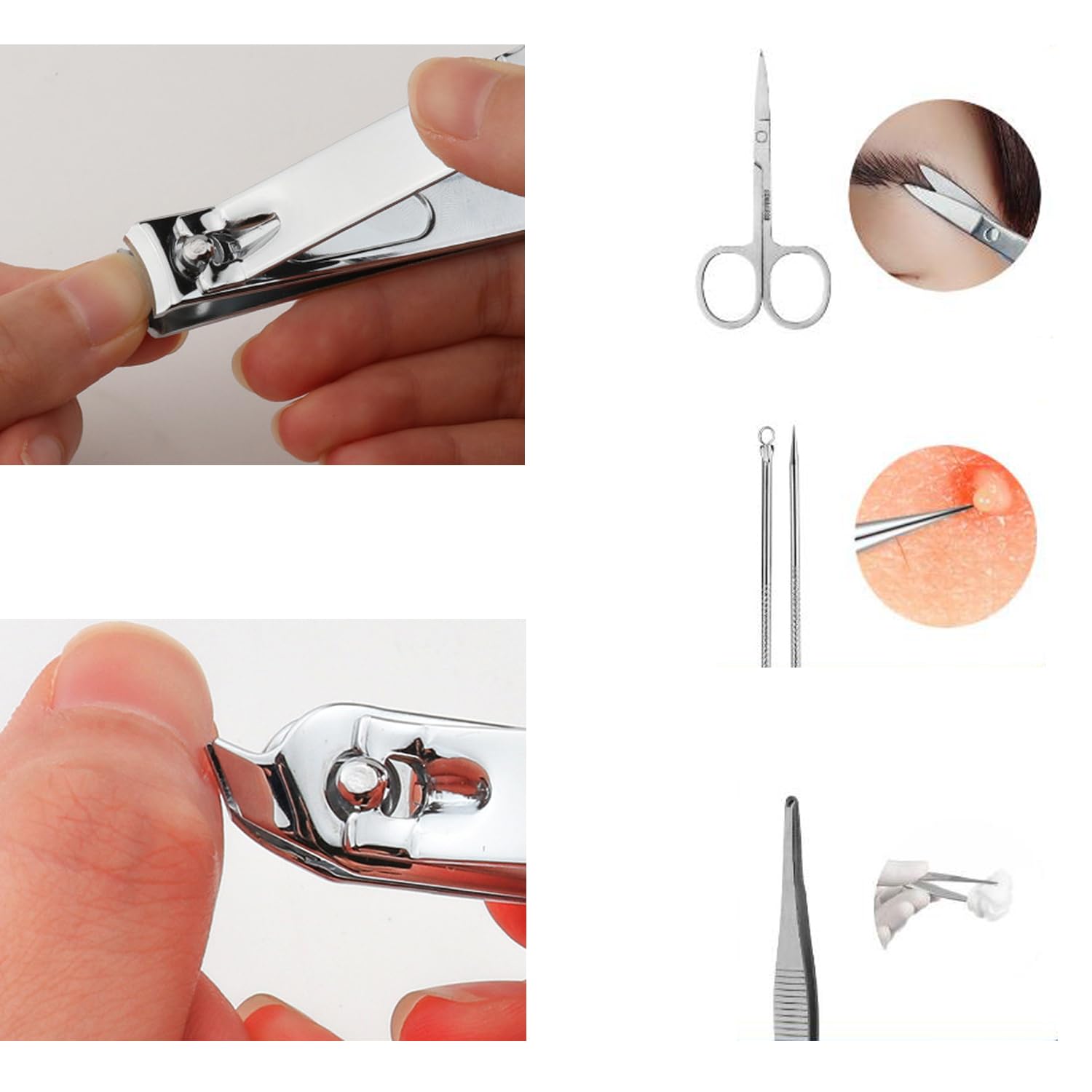Unghie Incarnite Piedi Kit Pads - 12 Pezzi, Strumenti per la Cura Del Piede, Manicure in Acciaio Inox Tagliaunghie Dei Set, Pedicure Professionale Overgrown e Unghie