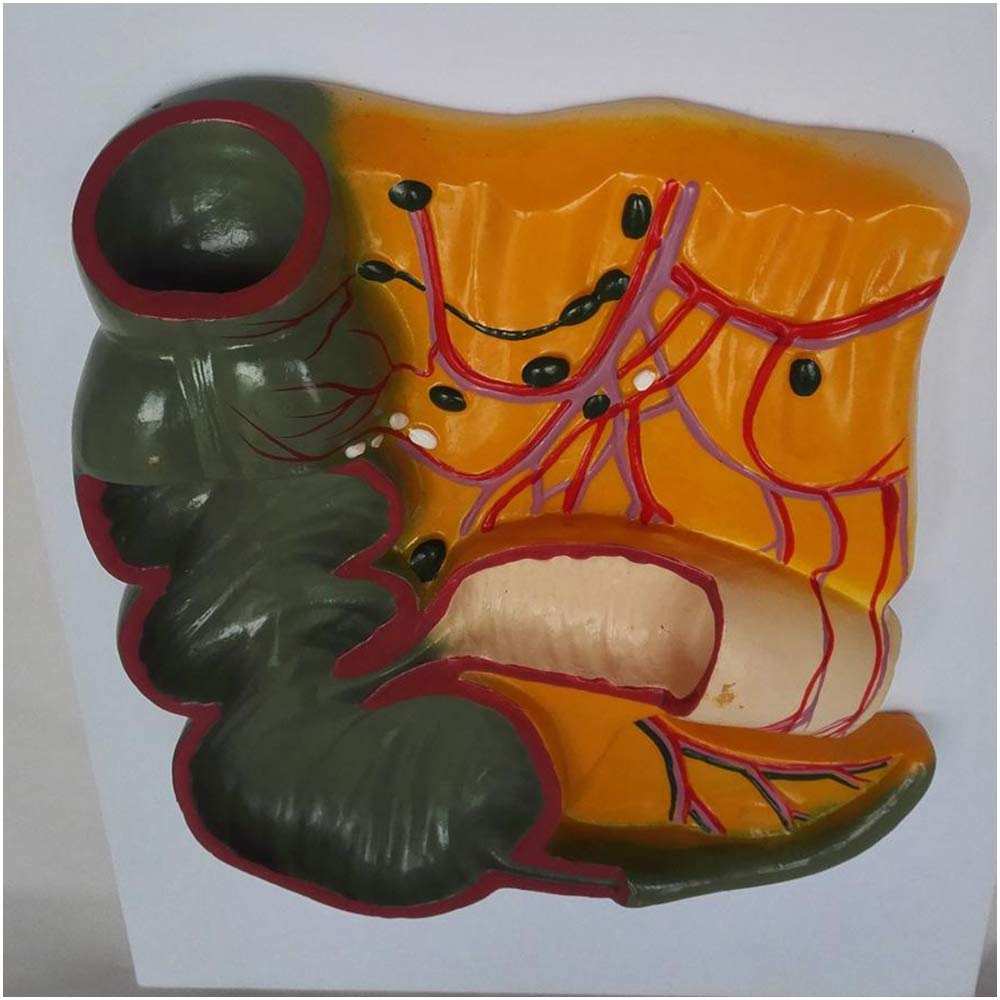 Sjdopulse Intestinal Anatomical Model - Human Appendix Cecum Anatomy Model - Human Organ Anatomical Model Intestinal Pathological Model - For Medical Study Teaching