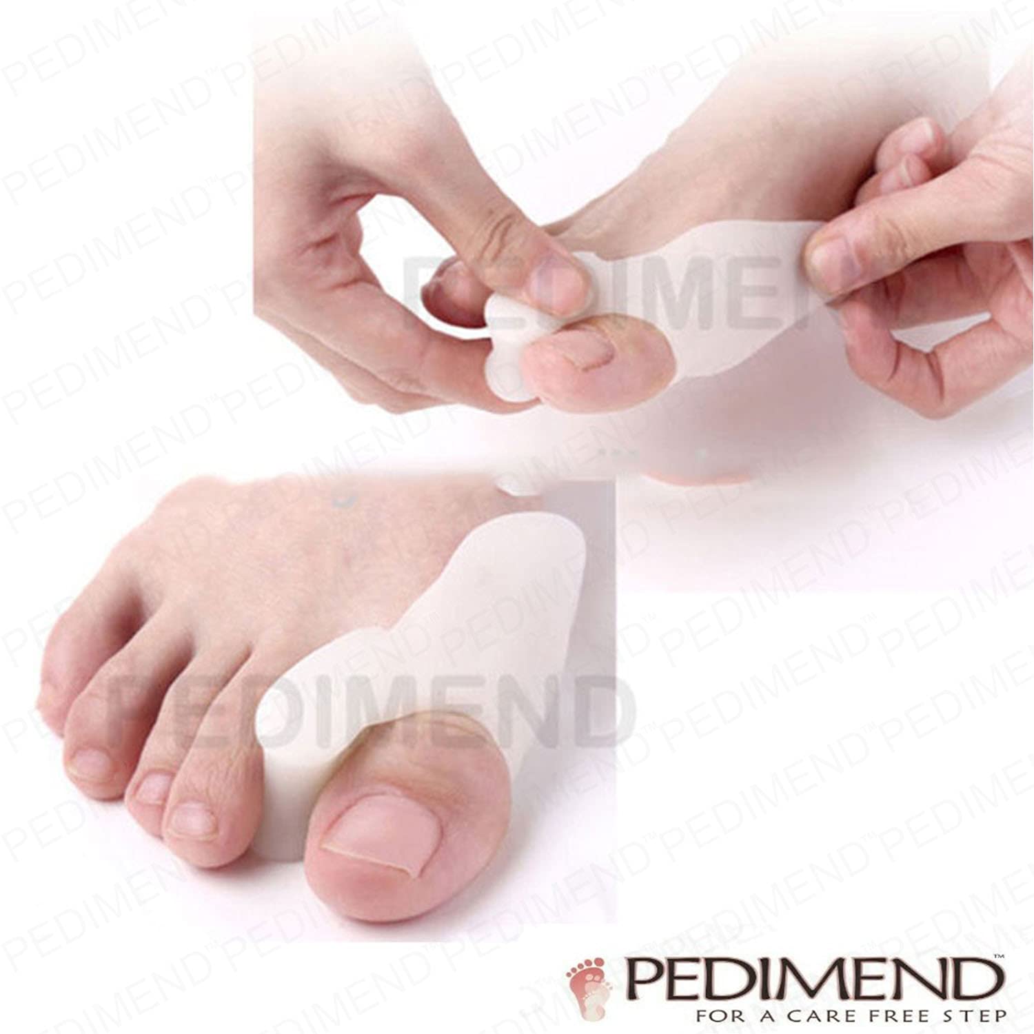 Pedimend 5 paia alluce valgo cuscino Splint | gel Bunion Guard Pads | Big Toe Bunion Protector per scarpe | assorbe pressure & Friction