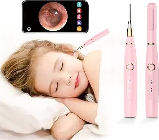 Endoscopios, Cámara de la oreja del endoscopio de eliminación de la cera del oído 4.3mm 72 0p fhd Oído inalámbrico Otoscop con 6 LED Luces