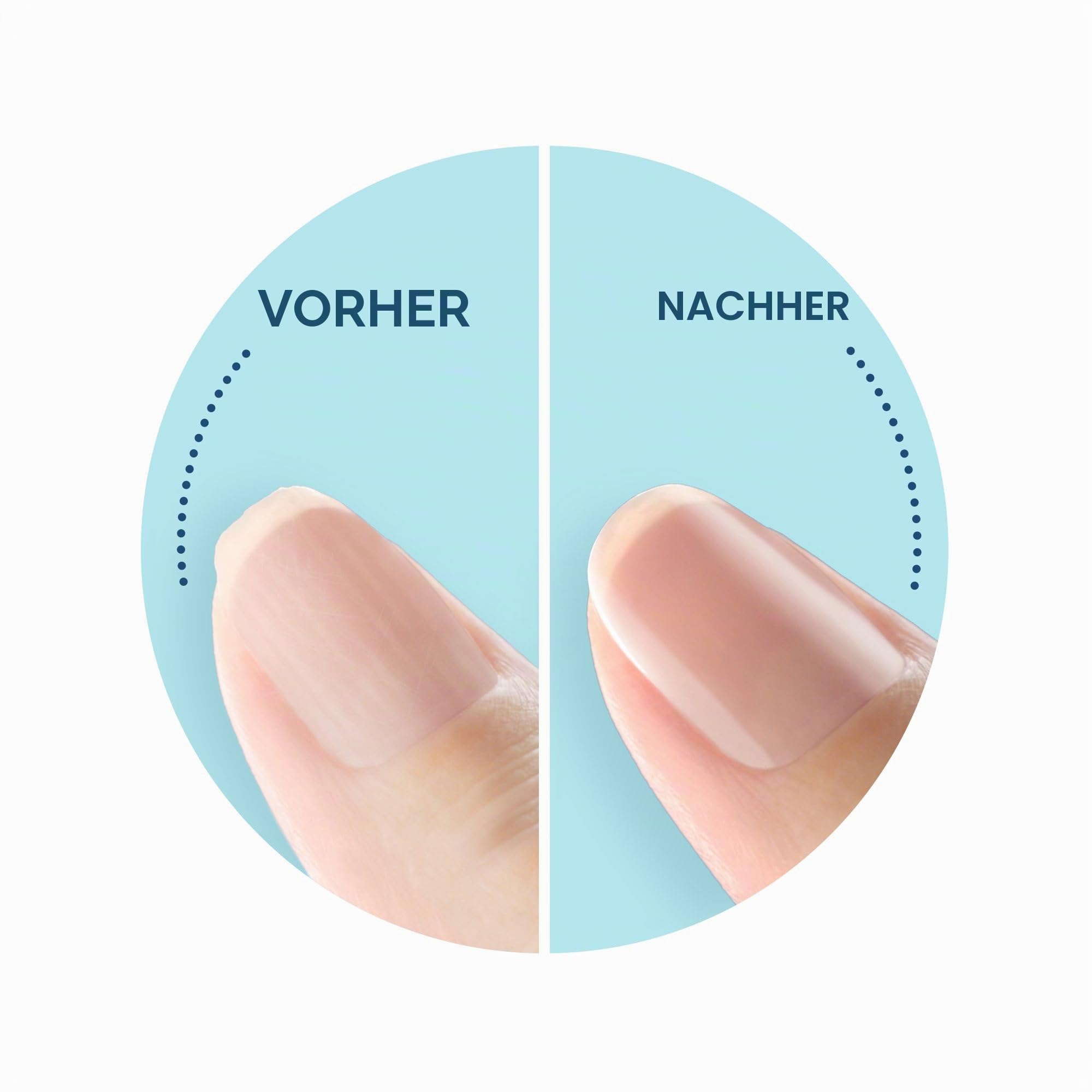 Scholl Velvet Smooth Elektronisches Nagelpflegesystem, blau, 1 Stück