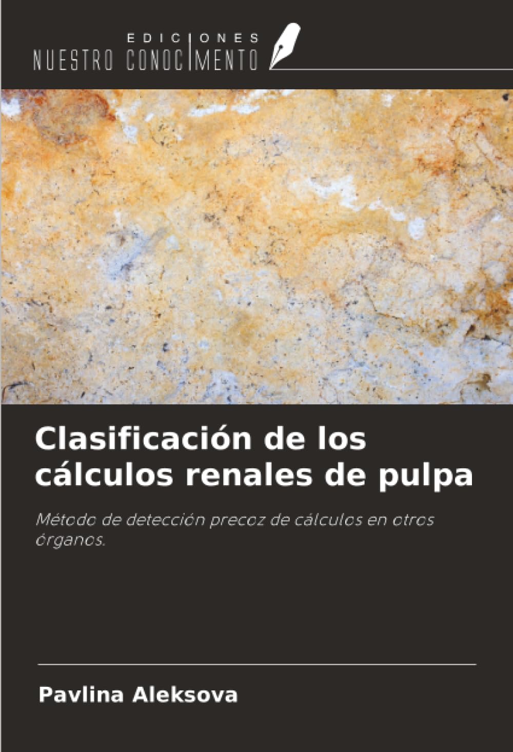 Clasificación de los cálculos renales de pulpa: Método de detección precoz de cálculos en otros órganos.
