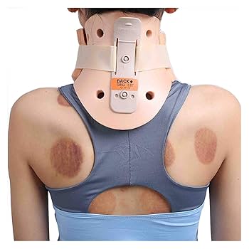 Amazon | Fiegcit ネックカラーフィラデルフィア頸部カラー医療