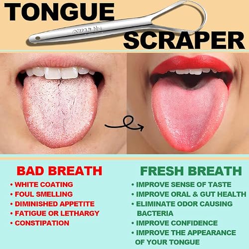 Kn Flax Tongue Scraper [2 Pack] [Medical Grade] Reduce Bad Breath Maintains Oral Care 100% Bpa Free Metal Tongue Scraper, Tongue Cleaner For Adults And Kids, Easy To Use With Non-Synthetic Handle #TOP1