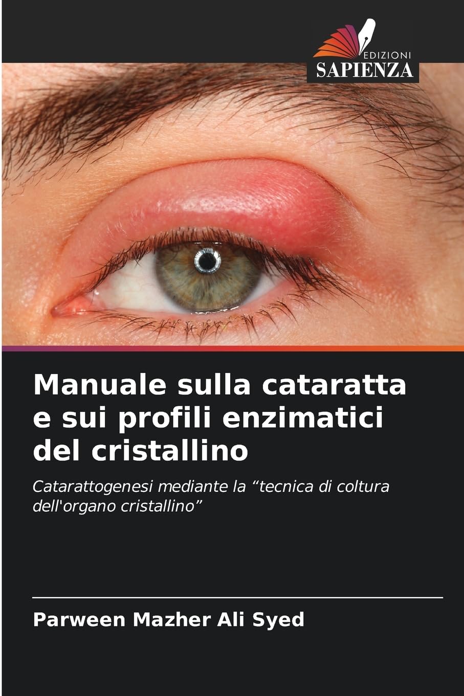 Manuale sulla cataratta e sui profili enzimatici del cristallino: Catarattogenesi mediante la “tecnica di coltura dell'organo cristallino”