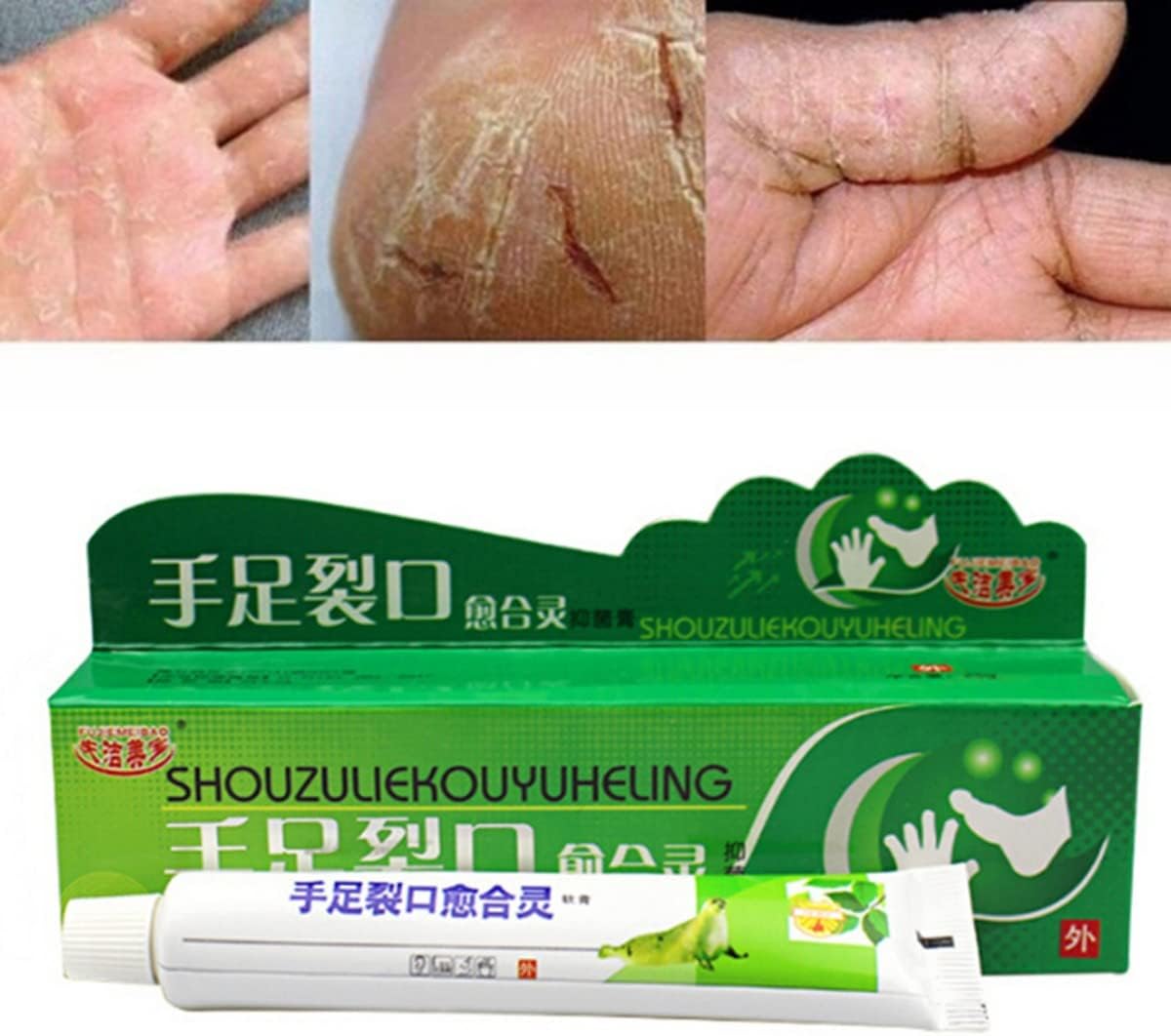 1pcs 25g Effective Powerful Hand Foot Crack Cream Heel Chapped Peeling Foot And Hand Repair Anti Dry Crack Skin Care Chinese Ointment