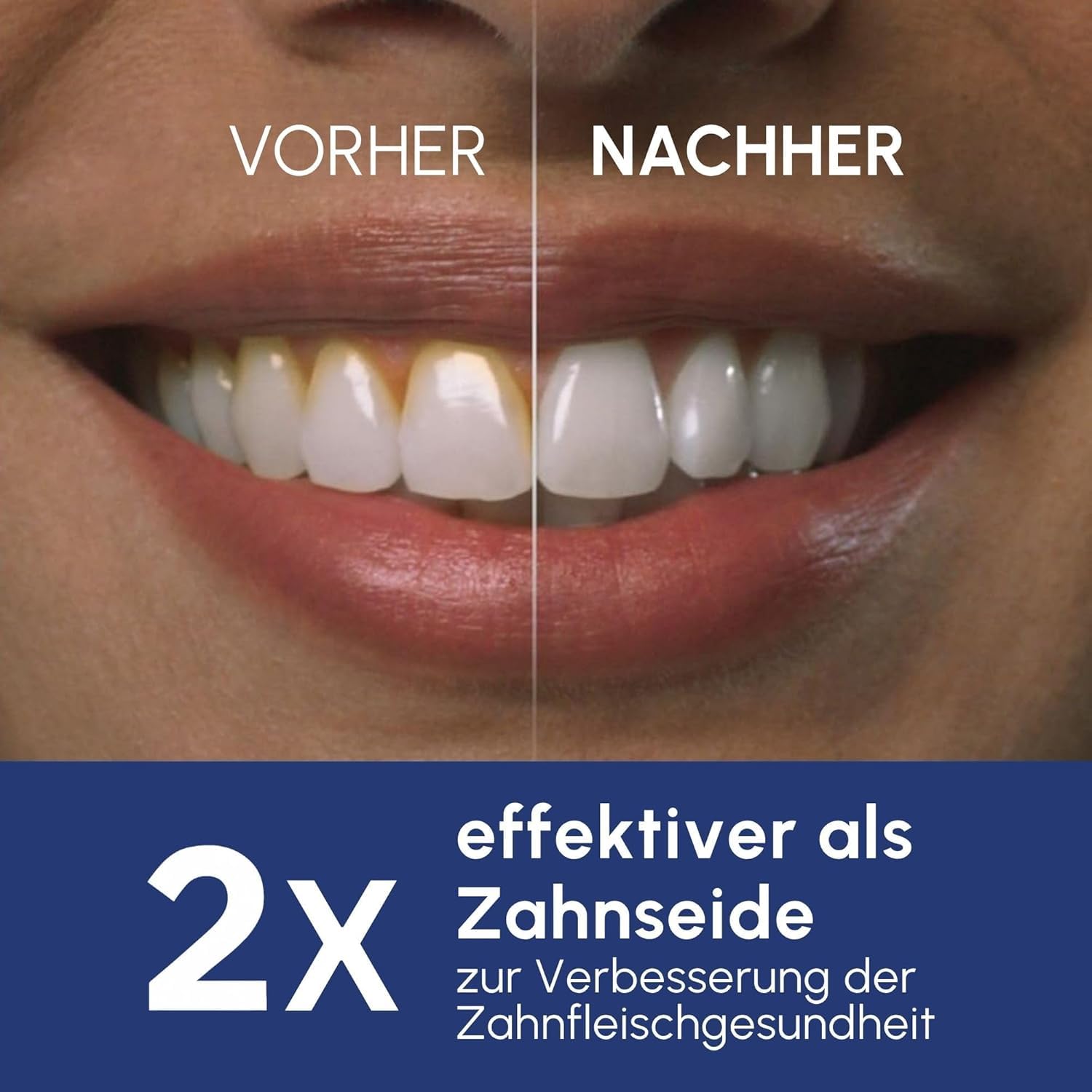 Waterpik Pulse Munddusche kabellos, Professionelle 99,9% Plaque Entfernung, 2 Intensitätsmodi, Zahnzwischenraumreiniger, 45 Sekunden Wassertankkapazität, 2x Aufsätze enthalten, mintgrün