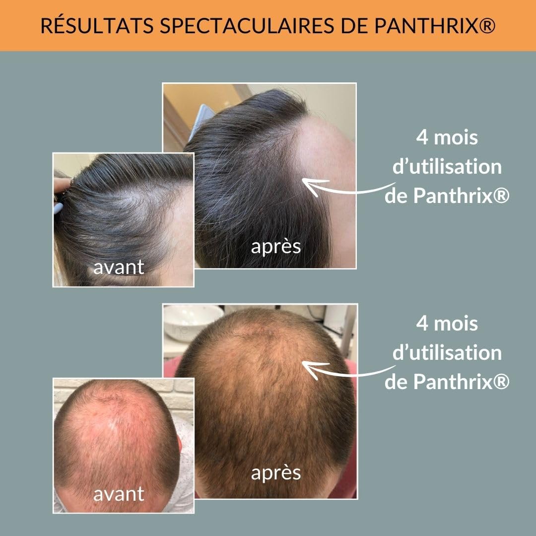 Panthrix Sérum Croissance Cheveux avec Redensyl 3% - Anti Chute & Repousse - Caféine, Kératine & Niacinamide - pour une Pousse Très Rapide - Homme & Femme - Fabriqué en Allemagne - 100 ml