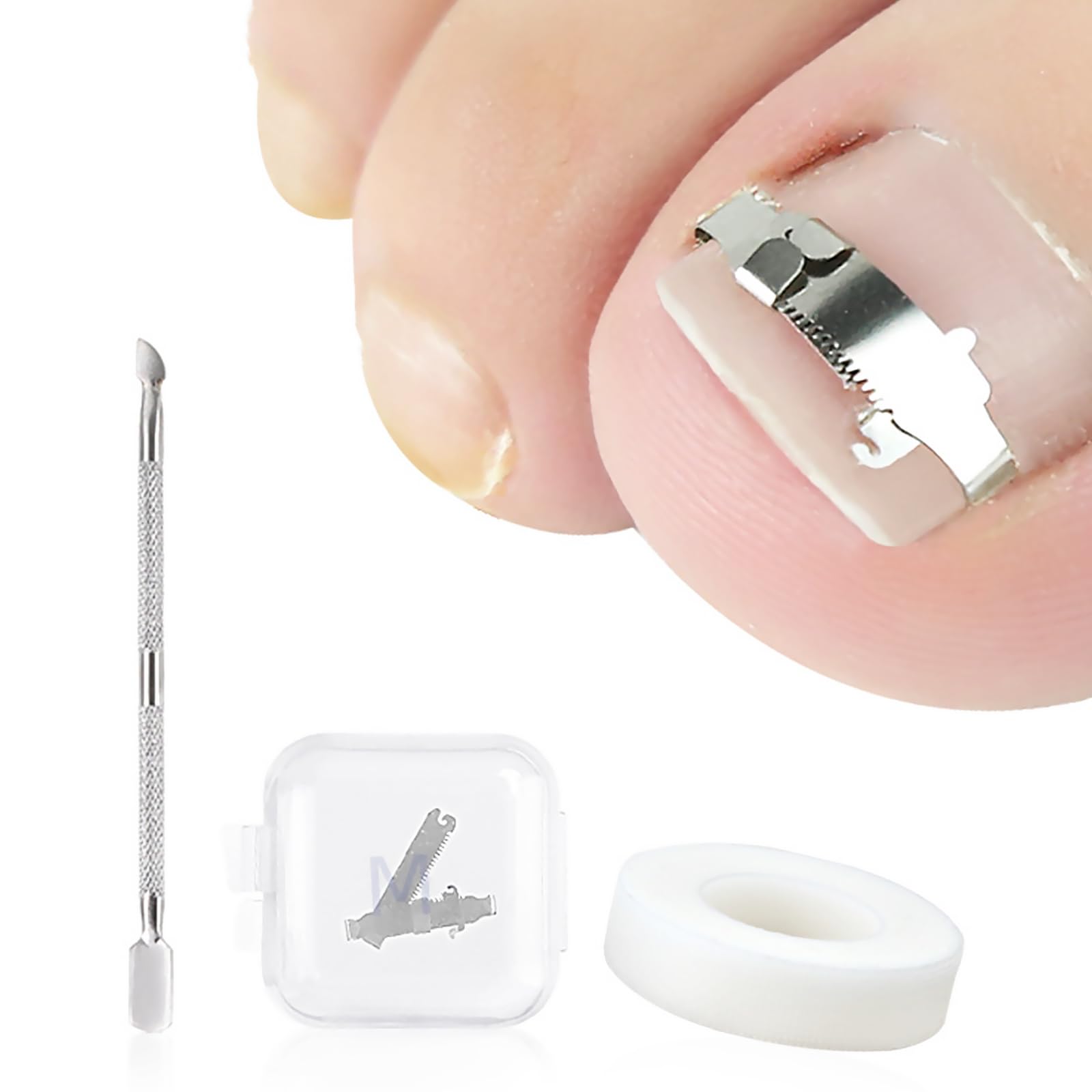 3 Pezzi Set Correttore per Unghie Incarnite Piedi, Fibbia Strumenti per Unghia Incarnita Alluce per Correzione, per l'Unghia del Piede, Correzione del Trattamento Paronichia