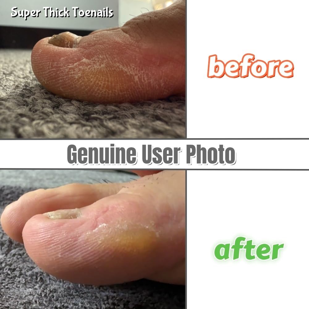 Stainless Steel Toe Nail File for Thick Nails & Ingrown Lifter-TCHT4