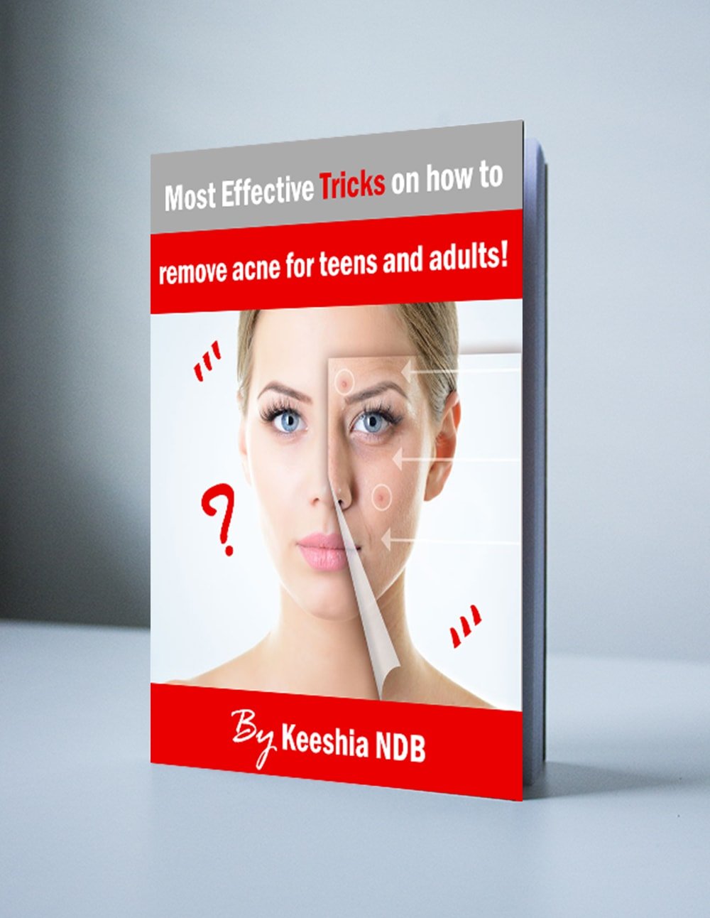 Amazon.com: Most effective trick on how to remove acne for teens and ...