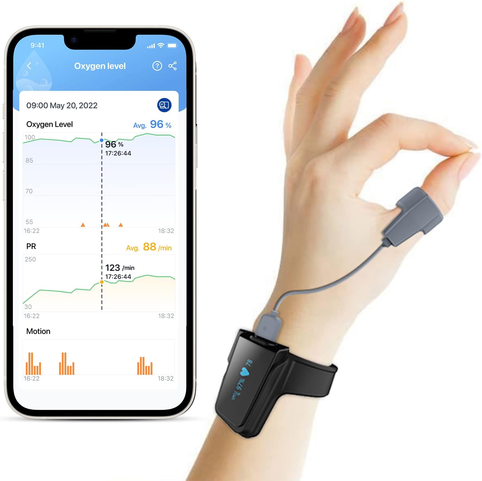 – ViATOM Checkme O2 Sleep Pulse Oximeter, Blood Oxygen Monitor Finger and Wrist with Bluetooth, Wearable Sleep Monitor with Continuous Monitoring, Professional APP&PC Report