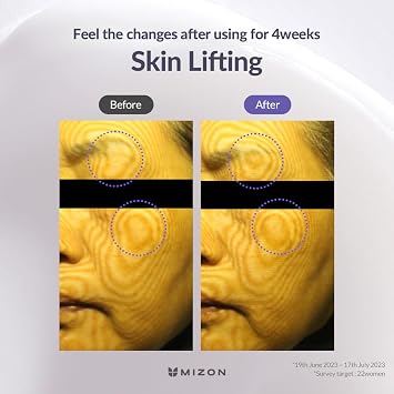 MIZON Hyalugen Le Lift Cream, 1.69 oz