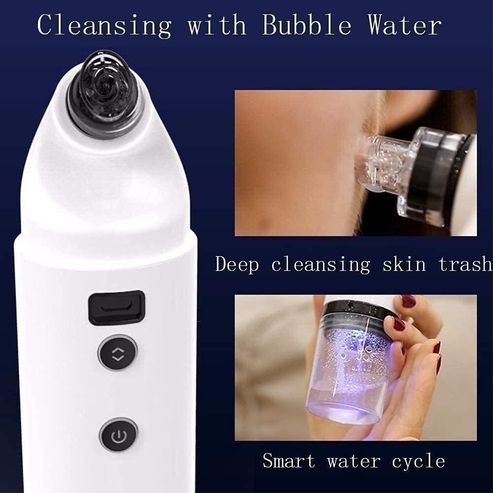 Blackhead Removal Tool, Pore Cleaner Electric Acne Extractor, USB Rechargeable with Upgraded Blue Light 4 Replaceable Suction Probes