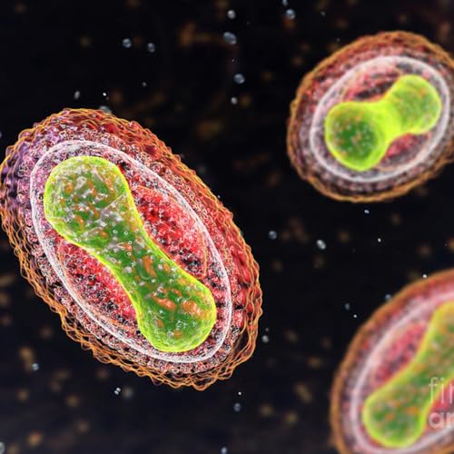 Smallpox epidemic of 1789