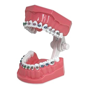Dental Typodont Orthodontic Teeth Model M7010-2 11 Standard Demo Teach Study with Archwire Ligature Ties Metal Brackets Buccal Tubes