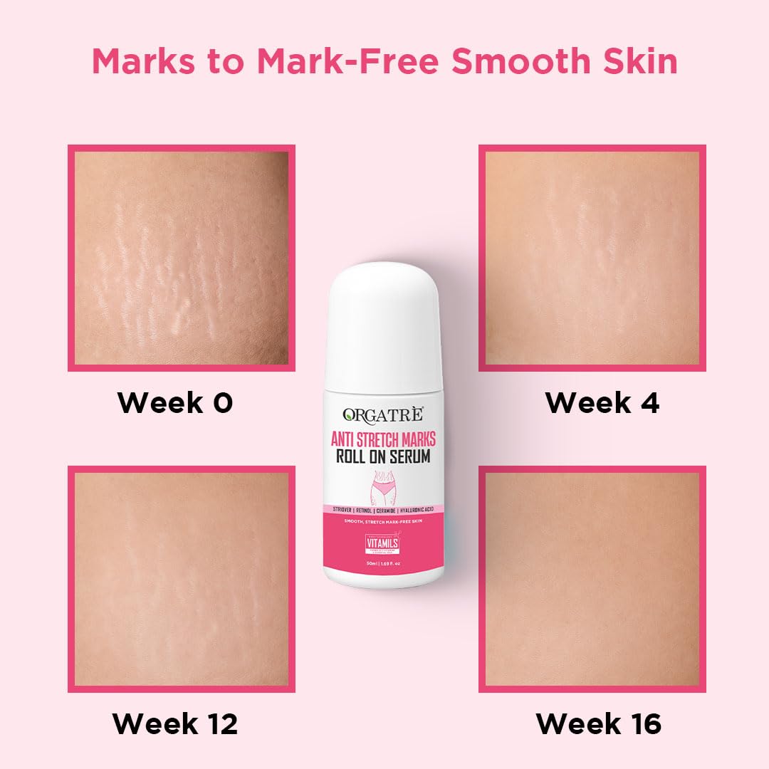 Orgatre Anti Stretch Marks Roll On Serum for Women With Striover | Retinol, Ceramide & Hyaluronic Acid | Lightweight & Non-Greasy | Reduces Stretch Marks & Boosts Elasticity | Safe for Pregnancy | 50ml - Image 2 thumbnail