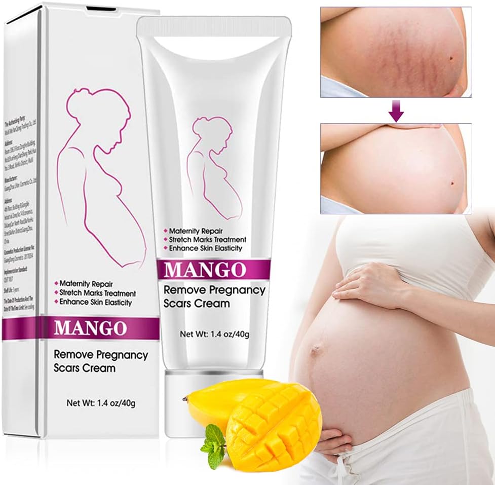 Stretch Mark Cream Scar Removal Cream Rapidly Eliminates Scars Maternity Stretch Mark Prevention Cream, Recovery Elasticity, Repair Scar Slack Line Abdomen Stretch Marks Postpartum