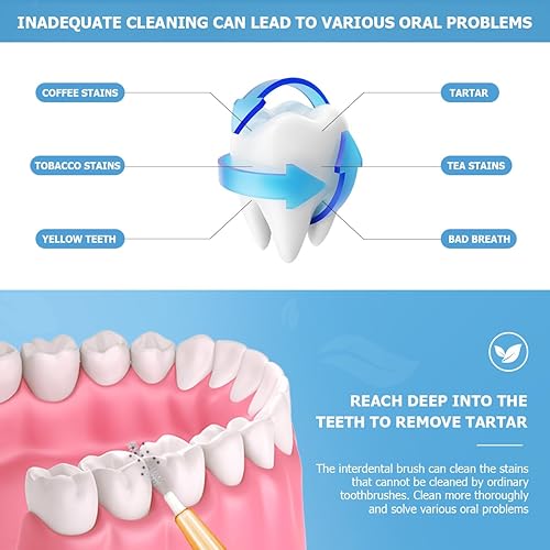 Miniatura 4 de 60 piezas de repuesto de palillo de dientes suave, cepillo interdental tipo empuje-tiro, herramienta de limpieza de dientes, cabezal de hilo dental,