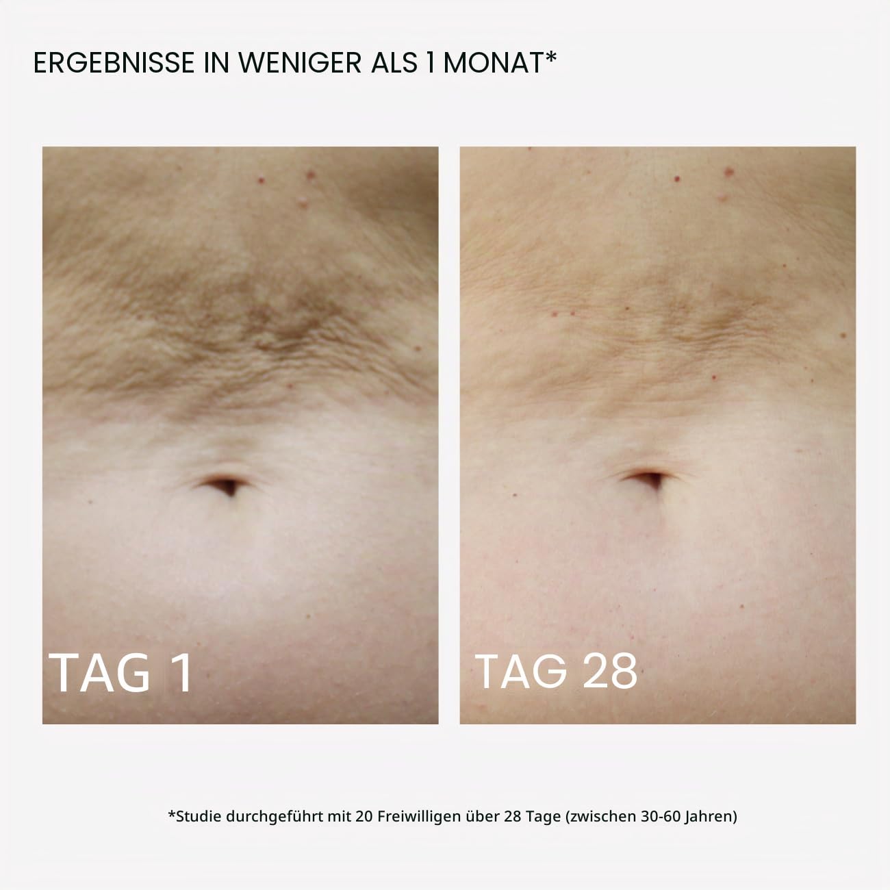 MASDERM Professionelles Radiofrequenz-Set für den Körper, 2-in-1, professionelles Funkgerät + straffende Körpercreme, 1 l, Kavitation