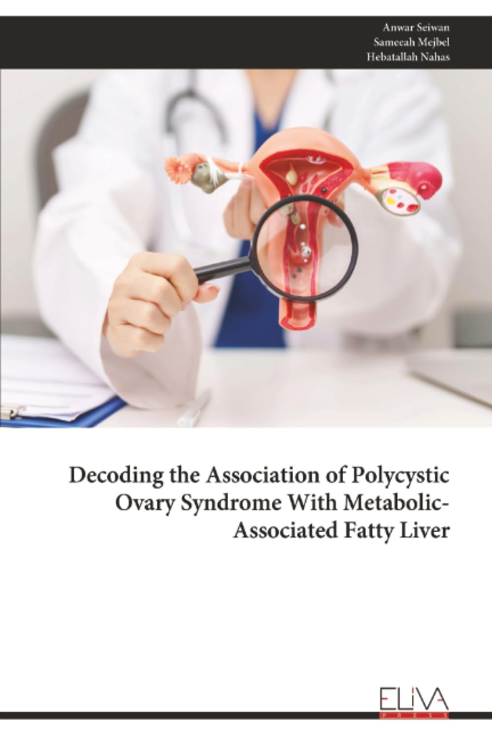 Decoding the Association of Polycystic Ovary Syndrome With Metabolic-Associated Fatty Liver