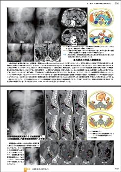 放射線科医のものの見方、考え方 放射線科医のものの見方・考え方 | 今西 好正, 小谷 博子 |本