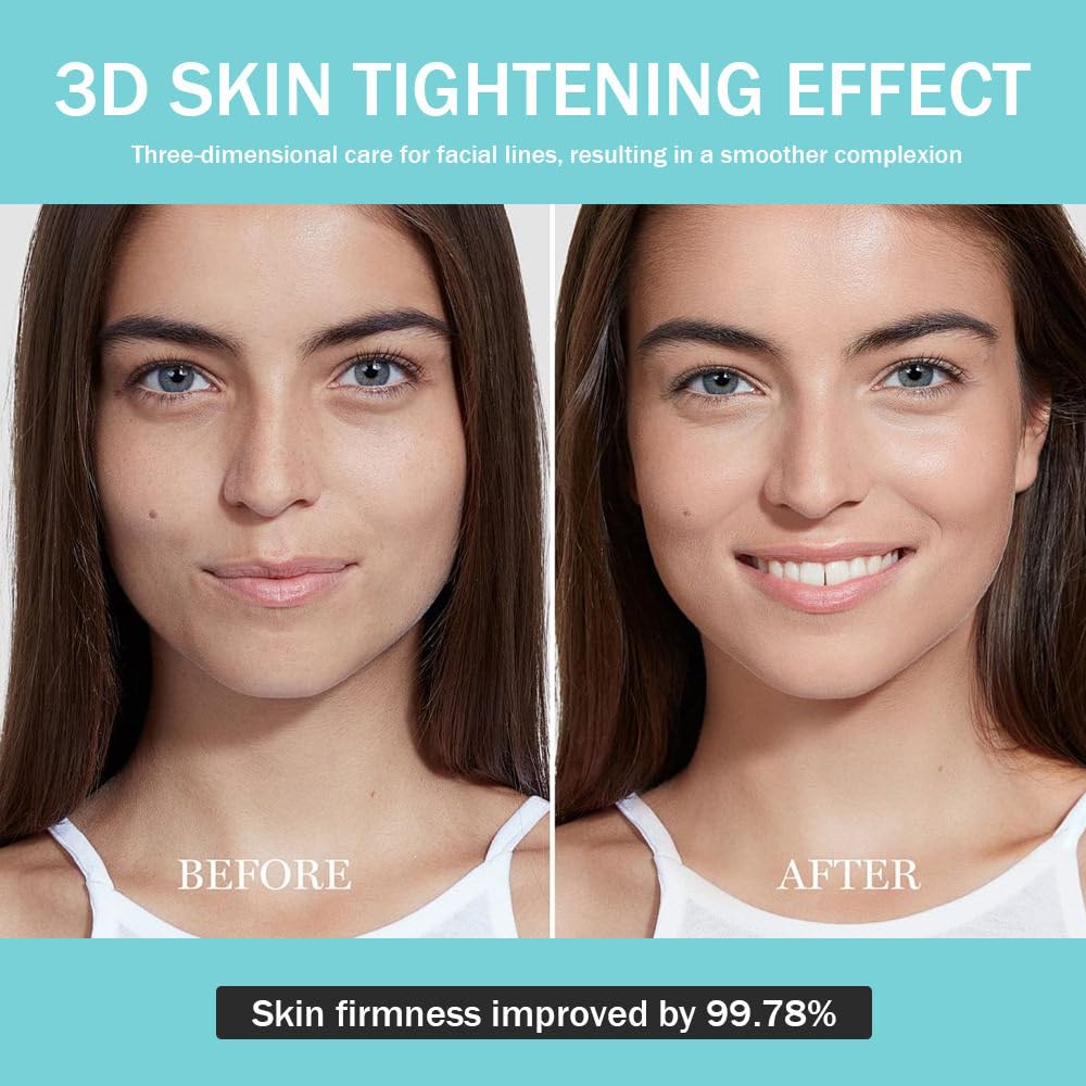 Hautpflegegerät – Gesichts-Glow-Booster, LED-Anti-Falten-Gerät, 5-Gang-Einstellung, Ausstrahlung, Elastizität, Maximierung Und Steigerung Der Hautpflegeaufnahme