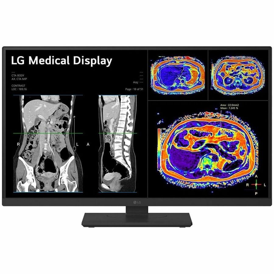 Image of LG 27HS713C-B 27 inch Class Webcam 4K UHD LED Monitor - 16:9 - Black