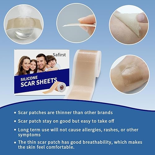 Miniatura 2 de Láminas de silicona para cicatrices de 1.6 x 59 pulgadas, rollo de 1.5 M, tratamiento de eliminación de cicatrices de silicona de grado médico para