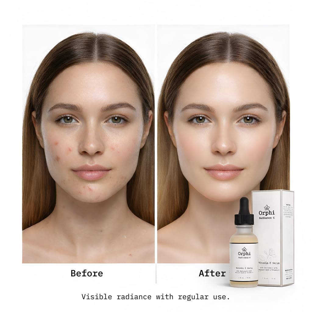 Orphi Radiance C Vitamin C Face Serum - Fragrance-Free Facial Serum with Hyaluronic Acid, Ferulic Acid & Vitamin E | Brightening & Anti-Aging Skincare for Women & Sensitive Skin | Made in USA - Image 5