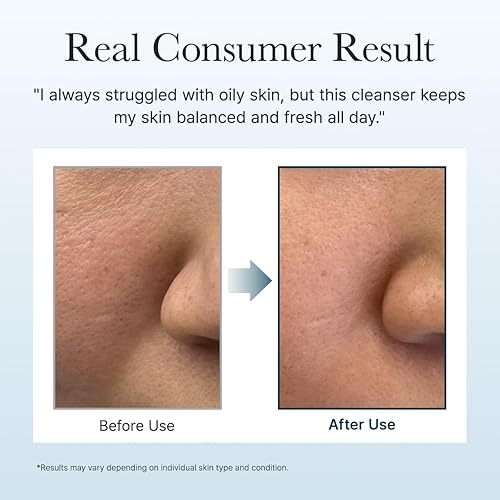 Miniatura 6 de ARENCIA Exfoliante y Limpiador Facial Profundo Iluminador de Hisopo - Todos los Tipos de Piel, Para Filamentos Sebáceos y Puntos Negros (1.76 oz)