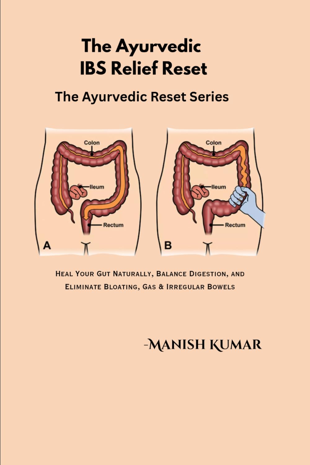 The Ayurvedic IBS Relief Reset: Heal Your Gut Naturally, Balance Digestion, and Eliminate Bloating, Gas & Irregular Bowels: 8 (The Ayurvedic Reset Series)