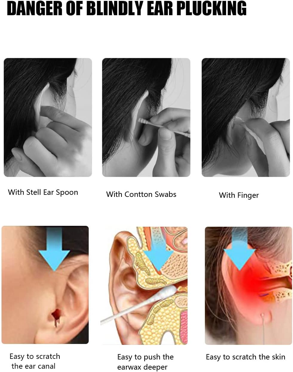 Ear Wax Removal Tool, Smart Visual Ear Cleaner, 1080P FHD Wireless Ear Otoscope with 6 LED Lights, 5 Ear Spoon & 8 Traditional Tools, IP67 Waterproof WiFi Ear Camera for iPhone, iPad & Android, White