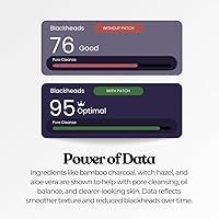 Vista 6 de The Patch Collection® – Tiras limpiadoras de poros para puntos negros Carbón, hamamelis, aloe vera (paquete de 20)