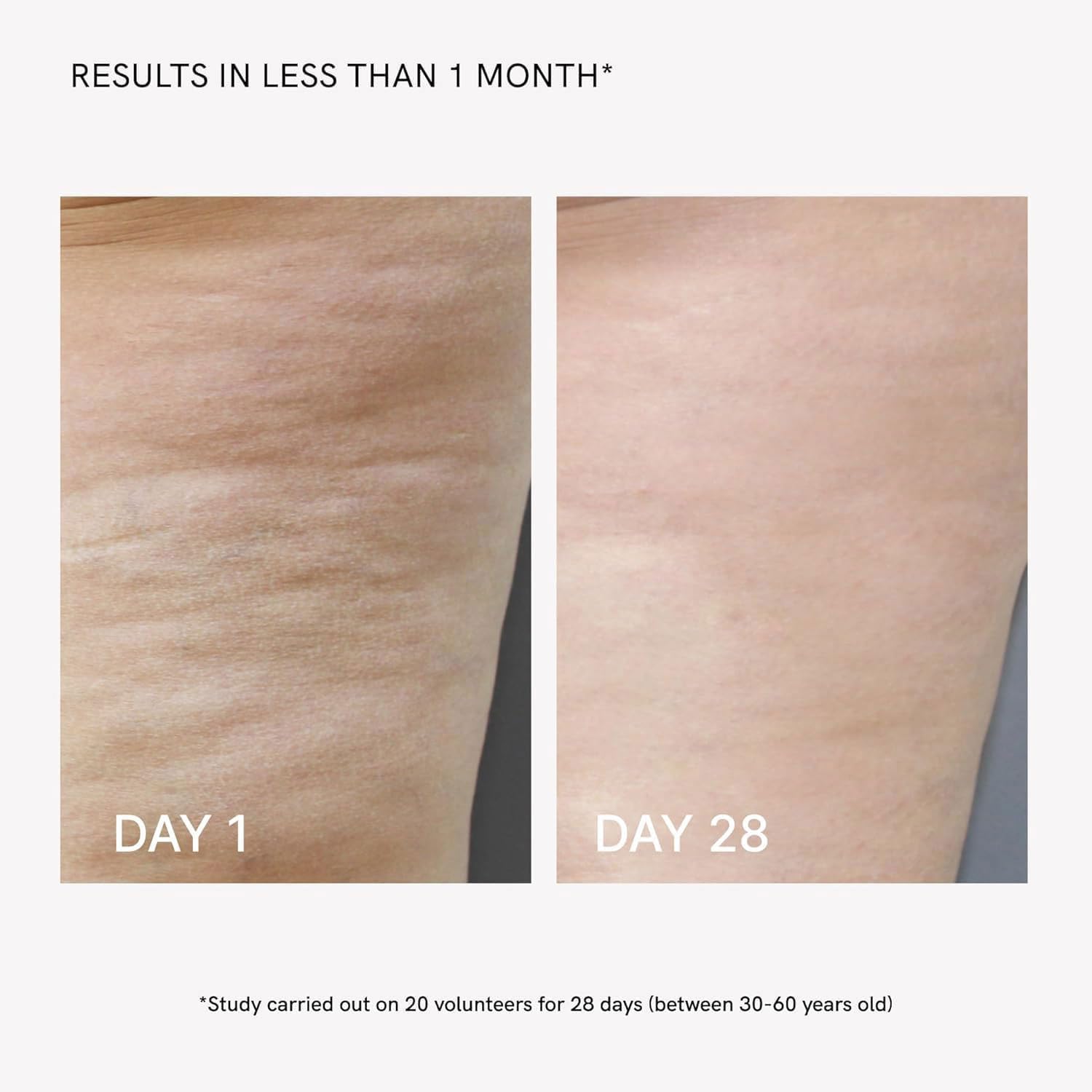 Sculpte Corps Professionnel EMS & RF, Dispositif Anti-Cellulite avec 4 Modes Amincissant, Raffermissement Peau, Remodelage Fessier et Cuisses Réduction Vergetures