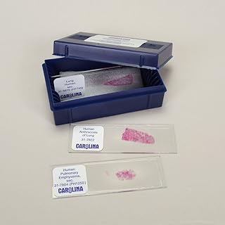 Human Lung Pathology Microscope Slide Set