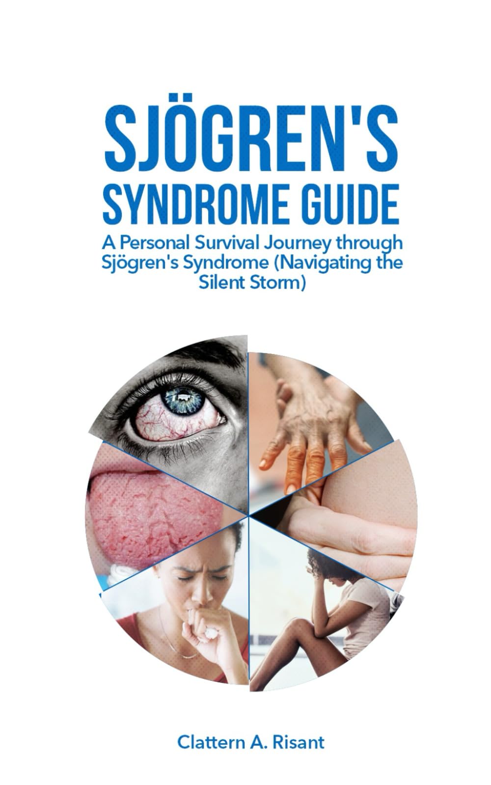 SJÖGREN'S SYNDROME GUIDE: A Personal Survival Journey through Sjögren's Syndrome (Navigating the Silent Storm)