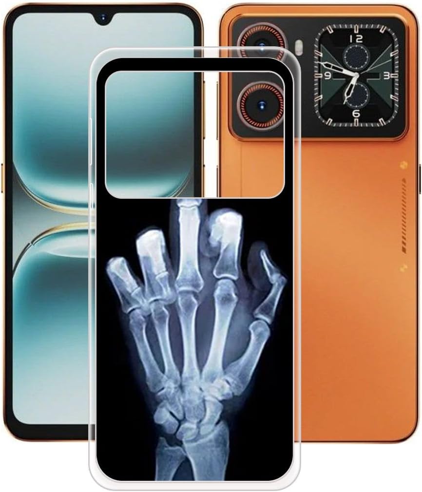 TPU Cover for Hotwav X100 GT (6,9") - WZ2