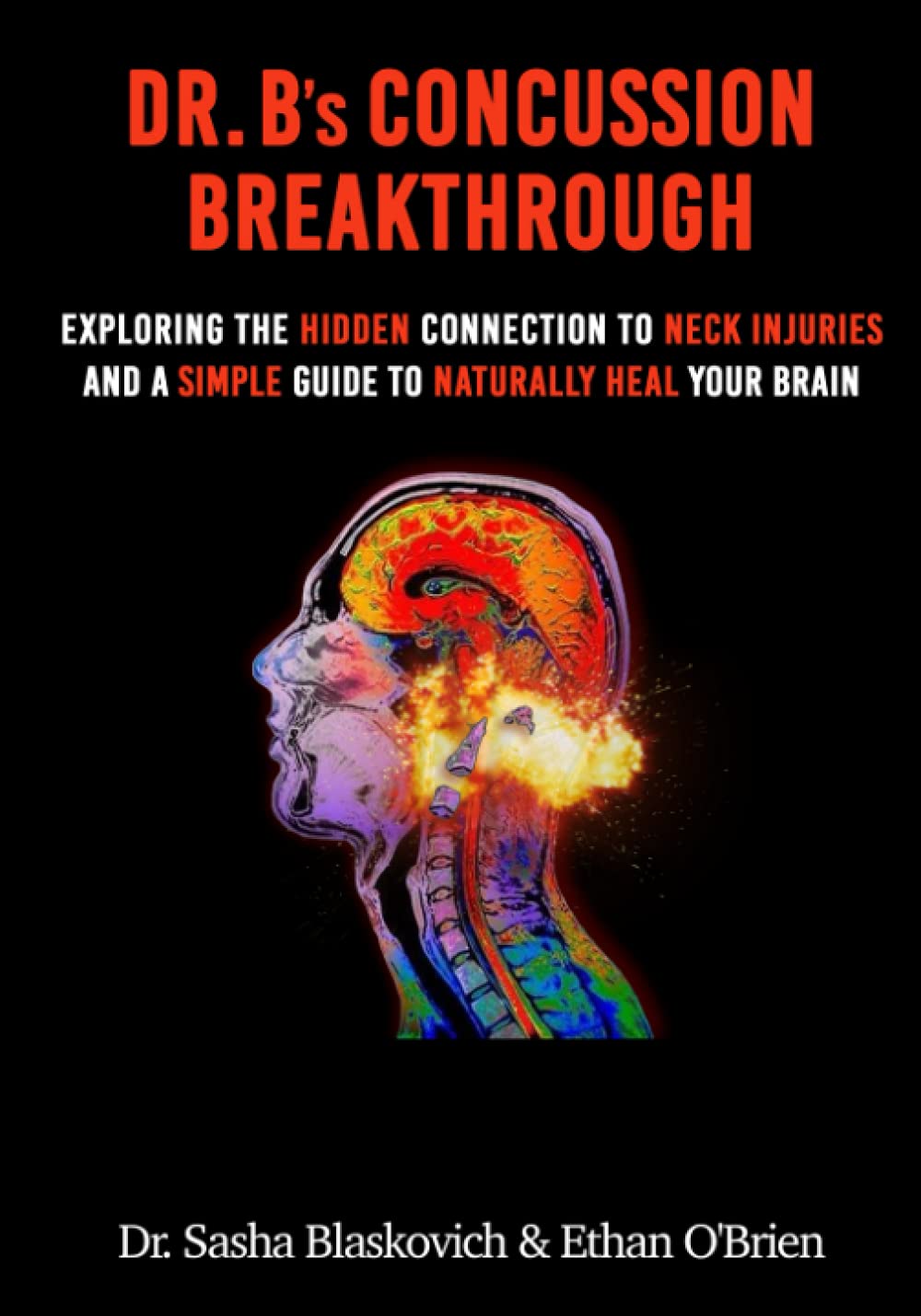 Dr. B’s Concussion Breakthrough: Exploring the Hidden Connection to Neck Injuries and a Simple Guide to Naturally Heal Your Brain