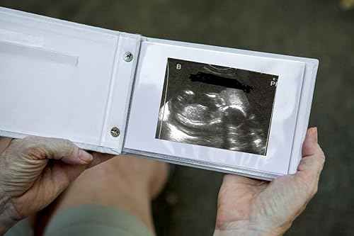 Milagro Ultrasonido/Sonograma/Embarazo Brag Photo Book