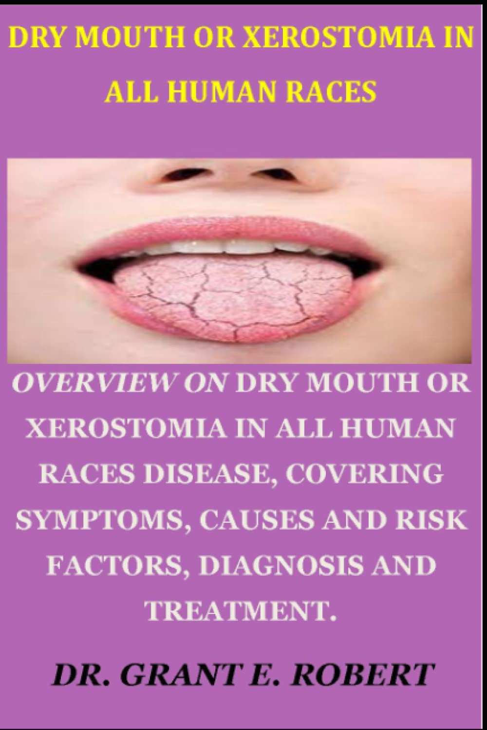 Buy DRY MOUTH OR XEROSTOMIA IN ALL HUMAN RACES OVERVIEW ON DRY MOUTH