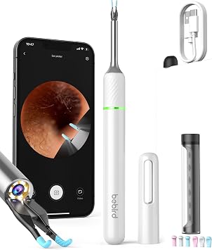 [قطع الحافة] BEBIRD Note5 منظف الأذن مع الكاميرا والتويتر - كاميرا أداة إزالة شمع الأذن - توزر الأذن مع كاميرا 10 ميجابيكسل ، تنظيف شمع الأذن مع 2 وضع اختيار الأذن والتلويزر