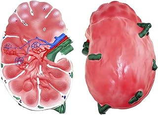 ICEMOB Lymph Node Magnified Model,Human Organ Anatomical Model,Science Classroom Learning Demonstration Teaching Model,31 * 20Cm