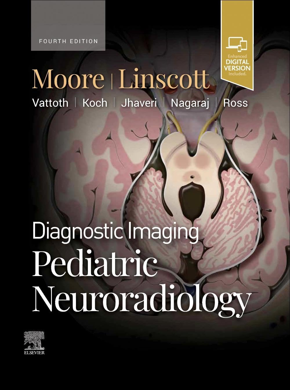 Diagnostic Imaging Pediatric Neuroradiology Moore MD, Kevin R