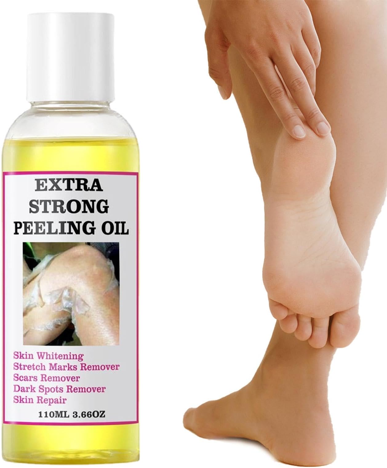 Yellow Peeling Oil,Skin Peeling Exfoliator,Skin Peeling Oil For Skin Lightening, Peeling Oil For Skin Brightening Moisturizing,Peeling Solution Exfoliatings Dark Skin For Body Lightening Bleaching