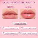 Glamveda Rice PDRN Lip Sleeping Mask for Dry & Chapped Lips | Deep Hydration & Moisture Lock | With Rice PDRN & Hyaluronic Acid | Soft, Smooth & Glossy Lips | 3.5g gallery image