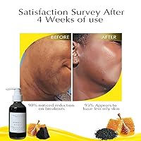 Vista 2 de Beauty Bamboo and Honey Face Wash Advanced Face Cleanser for Oily Skin Hydrating and Deeply Cleansing Activated Charcoal Face Wash for Acne Prone